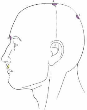 antitraumatica